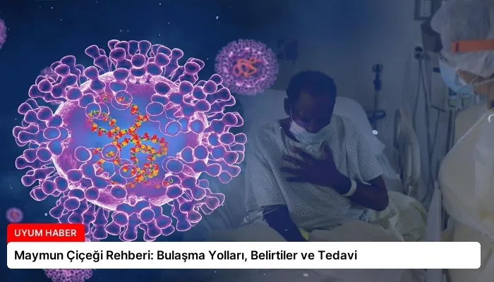 Maymun Çiçeği Rehberi: Bulaşma Yolları, Belirtiler ve Tedavi