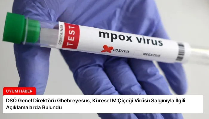 DSÖ Genel Direktörü Ghebreyesus, Küresel M Çiçeği Virüsü Salgınıyla İlgili Açıklamalarda Bulundu