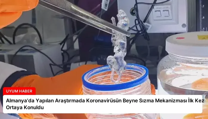 Almanya’da Yapılan Araştırmada Koronavirüsün Beyne Sızma Mekanizması İlk Kez Ortaya Konuldu