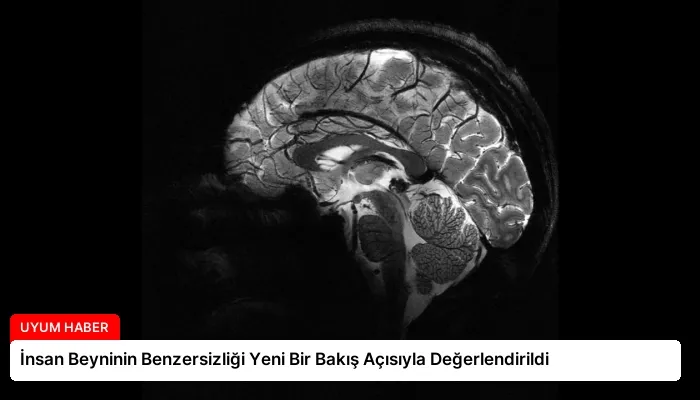 İnsan Beyninin Benzersizliği Yeni Bir Bakış Açısıyla Değerlendirildi