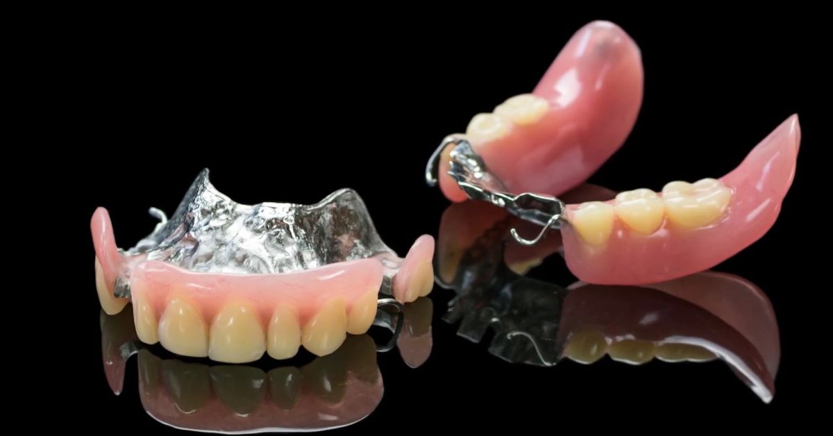 Hareketli Protez Nedir?